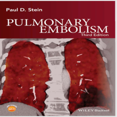 Pulmonary Embolism - Paul Stein , 3E Pulmonary Embolism - Paul Stein , 3E